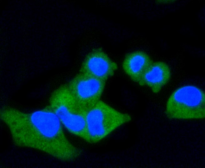IF(ICC) staining with CD86 (4G10) Monoclonal Antibody (bsm-52375R) at 1:100 in HeLa cells (green). The nuclear counterstain is DAPI (blue). Cells were fixed in paraformaldehyde, permeabilized with 0.25% Triton X100/PBS.