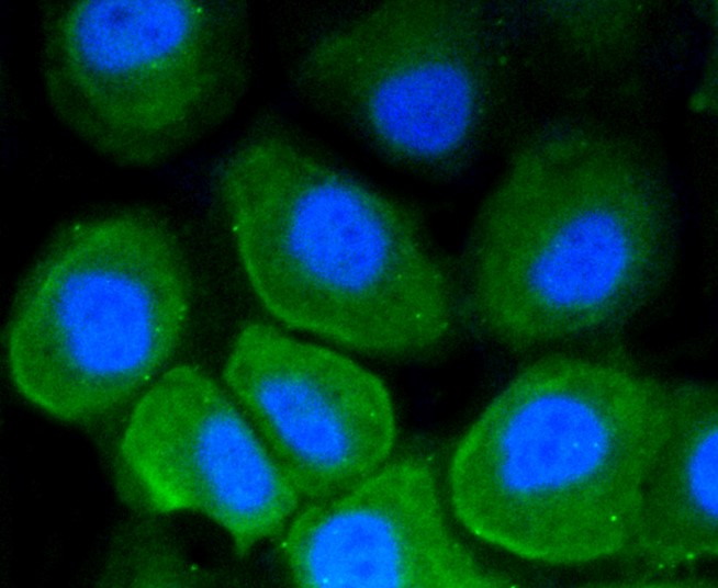 IF(ICC) staining with CD86 (4G10) Monoclonal Antibody (bsm-52375R) at 1:100 in HUVEC cells (green). The nuclear counterstain is DAPI (blue). Cells were fixed in paraformaldehyde, permeabilized with 0.25% Triton X100/PBS.