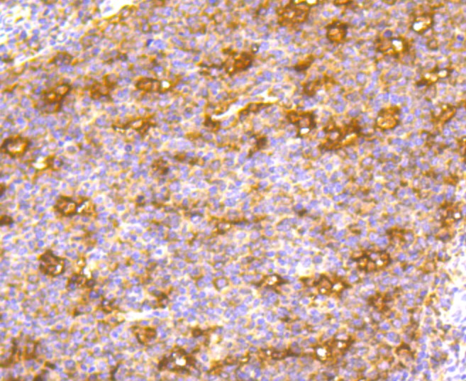 Paraformaldehyde-fixed and paraffin-embedded Human tonsil tissue incubated with CD86 (4G10) Monoclonal Antibody (bsm-52375R) at 1:100, overnight at 4°C, followed by a conjugated secondary antibody and DAB staining. Counterstained with hematoxylin.