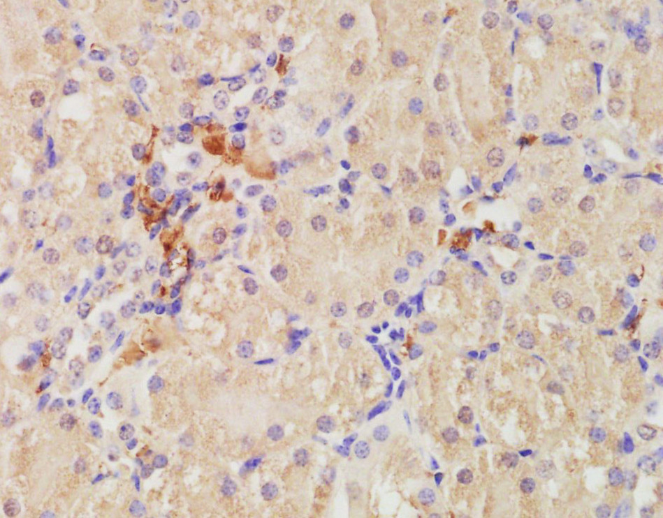 Paraformaldehyde-fixed, paraffin-embedded Mouse Kidney issue; Antigen retrieval by boiling in sodium citrate buffer (0.01M, pH6) for 15 minutes; Block endogenous peroxidase by 3% hydrogen peroxide for 30 minutes; Blocking buffer (normal goat serum) at 37°C for 20 minutes; Antibody incubation with CD68 Polyclonal Antibody, Unconjugated (bs-0649R) at 1:200 overnight at 4°C, followed by incubation with a conjugated secondary antibody, DAB and counterstaining.