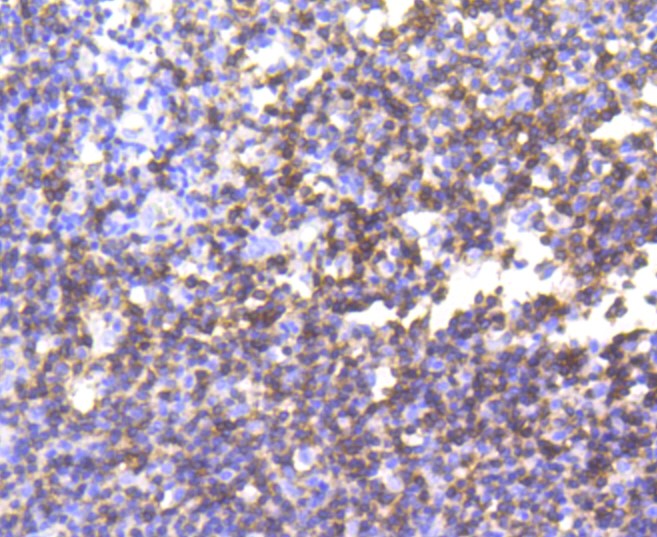 Paraformaldehyde-fixed and paraffin-embedded Human tonsil tissue incubated with CD3 epsilon (7A4) Monoclonal Antibody (bsm-52386R) at 1:100, overnight at 4°C, followed by a conjugated secondary antibody and DAB staining. Counterstained with hematoxylin. Paraformaldehyde-fixed and paraffin-embedded Human tonsil tissue incubated with CD3 epsilon (7A4) Monoclonal Antibody (bsm-52386R) at 1:100, overnight at 4°C, followed by a conjugated secondary antibody and DAB staining. Counterstained with hematoxylin.