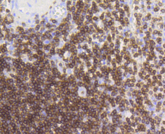 Paraformaldehyde-fixed and paraffin-embedded Human spleen tissue incubated with CD3 epsilon (7A4) Monoclonal Antibody (bsm-52386R) at 1:100, overnight at 4°C, followed by a conjugated secondary antibody and DAB staining. Counterstained with hematoxylin. Paraformaldehyde-fixed and paraffin-embedded Human spleen tissue incubated with CD3 epsilon (7A4) Monoclonal Antibody (bsm-52386R) at 1:100, overnight at 4°C, followed by a conjugated secondary antibody and DAB staining. Counterstained with hematoxylin.