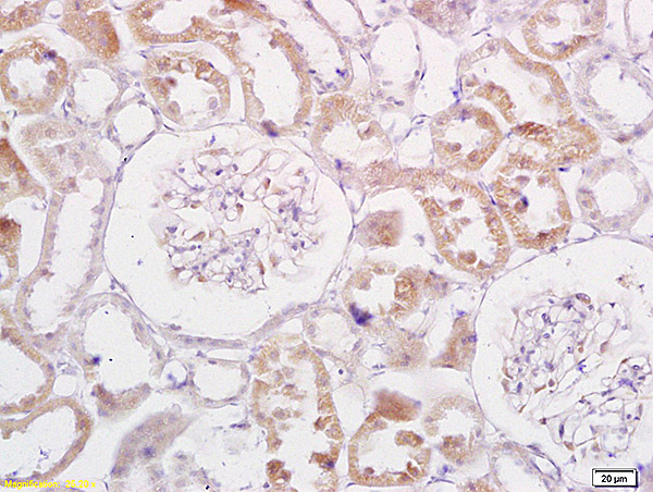 Formalin-fixed and paraffin embedded rat kidney  labeled with Anti-TRADD Polyclonal Antibody, Unconjugated (bs-1202R) at 1:200 followed by conjugation to the secondary antibody and DAB staining.
