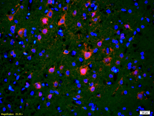 Formalin-fixed and paraffin embedded rat brain labeled with Rabbit Anti CDC40 Polyclonal Antibody, Unconjugated (bs-4295R) at 1:200, overnight at 4°C, The secondary antibody was Goat Anti-Rabbit IgG, Cy3 conjugated(bs-0295G-Cy3)used at 1:200 dilution for 40 minutes at 37°C.