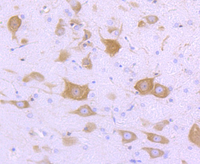 Paraformaldehyde-fixed and paraffin-embedded Rat brain tissue incubated with FMRP (1B6) Monoclonal Antibody (bsm-52945R) at 1:100, overnight at 4\u00b0C, followed by a conjugated secondary antibody and DAB staining. Counterstained with hematoxylin.