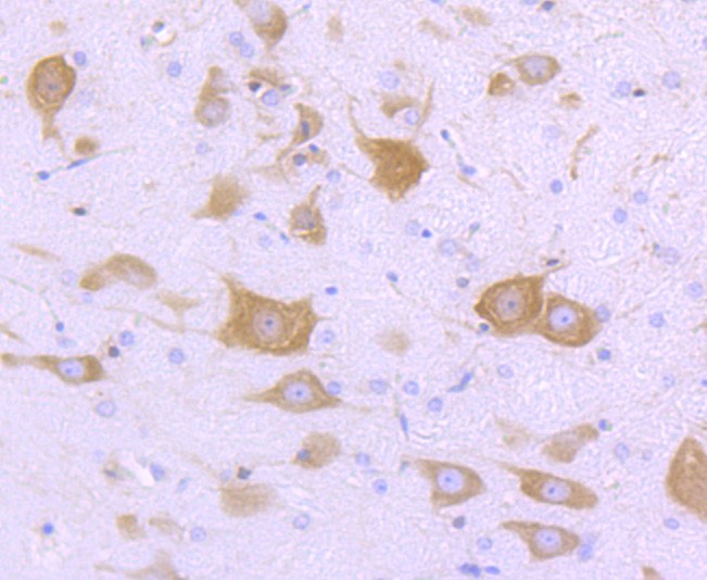 Paraformaldehyde-fixed and paraffin-embedded Rat brain tissue incubated with FMRP (1B6) Monoclonal Antibody (bsm-52945R) at 1:100, overnight at 4°C, followed by a conjugated secondary antibody and DAB staining. Counterstained with hematoxylin.