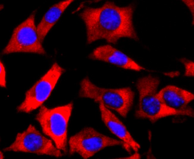 IF(ICC) staining with FMRP (1B6) Monoclonal Antibody (bsm-52945R) at 1:200 in SH-SY5Y cells (red). The nuclear counterstain is DAPI (blue). Cells were fixed in paraformaldehyde, permeabilized with 0.25% Triton X100\/PBS.