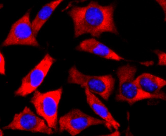 IF(ICC) staining with FMRP (1B6) Monoclonal Antibody (bsm-52945R) at 1:200 in SH-SY5Y cells (red). The nuclear counterstain is DAPI (blue). Cells were fixed in paraformaldehyde, permeabilized with 0.25% Triton X100/PBS.