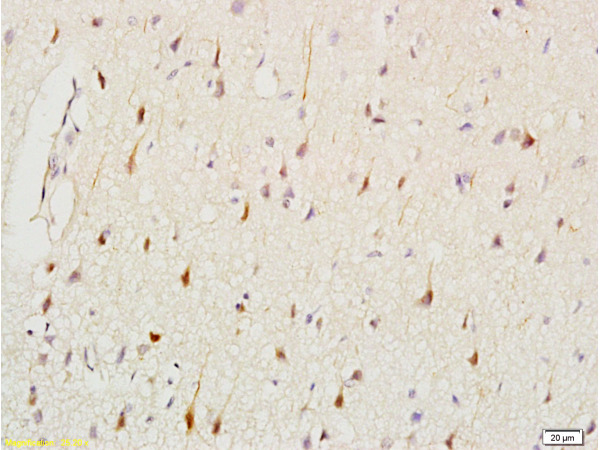 Formalin-fixed and paraffin embedded: rat brain tissue labeled with Anti-CK2 Polyclonal Antibody (bs-1005R), Unconjugated at 1:200, followed by conjugation to the secondary antibody and DAB staining