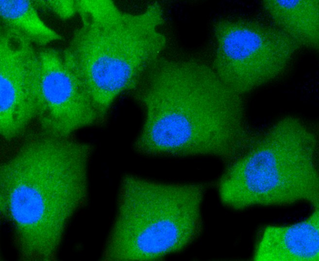 IF(ICC) staining with PKC alpha (2A1) Monoclonal Antibody (bsm-52409R) at 1:100 in A549 cells (red). The nuclear counterstain is DAPI (blue). Cells were fixed in paraformaldehyde, permeabilized with 0.25% Triton X100/PBS.