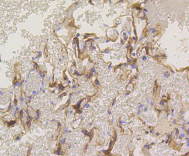 Paraformaldehyde-fixed and paraffin-embedded Human lung tissue incubated with PKC alpha (2A1) Monoclonal Antibody (bsm-52409R) at 1:100, overnight at 4°C, followed by a conjugated secondary antibody and DAB staining. Counterstained with hematoxylin.