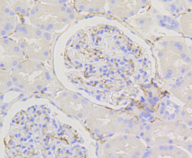 Paraformaldehyde-fixed and paraffin-embedded Human kidney tissue incubated with Caldesmon (14G2) Monoclonal Antibody (bsm-52411R) at 1:100, overnight at 4°C, followed by a conjugated secondary antibody and DAB staining. Counterstained with hematoxylin.