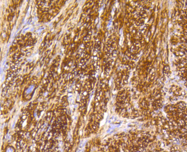 Paraformaldehyde-fixed and paraffin-embedded Human uterus tissue incubated with Caldesmon (14G2) Monoclonal Antibody (bsm-52411R) at 1:100, overnight at 4°C, followed by a conjugated secondary antibody and DAB staining. Counterstained with hematoxylin.