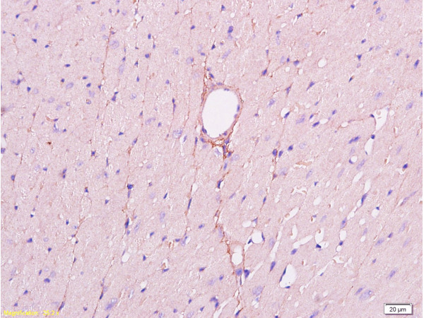 Formalin-fixed and paraffin embedded mouse heart tissue labeled Anti-CD34 Polyclonal Antibody, Unconjugated (bs-0646R) at 1:200, followed by conjugation to the secondary antibody and DAB staining