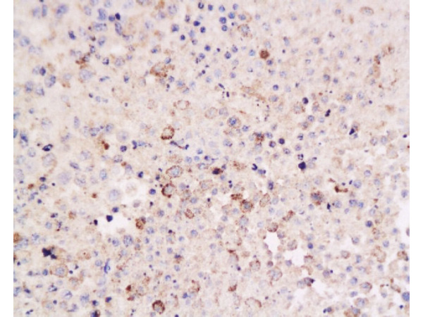 Formalin-fixed and paraffin embedded mouse lymphoma tissue labeled Anti-CD8 Polyclonal Antibody, Unconjugated(bs-0648R)  at 1:200, followed by conjugation to the secondary antibody and DAB staining