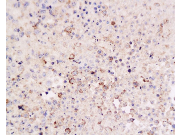 Formalin-fixed and paraffin embedded mouse lymphoma tissue labeled Anti-CD8 Polyclonal Antibody, Unconjugated(bs-0648R) at 1:200, followed by conjugation to the secondary antibody and DAB staining
