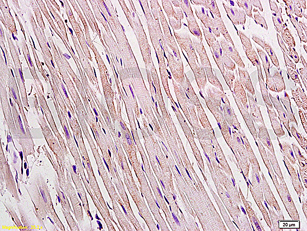Formalin-fixed and paraffin embedded rat heart tissue labeled Anti-Connexin 43 Polyclonal Antibody, Unconjugated (bs-0651R)  at 1:200, followed by conjugation to the secondary antibody and DAB staining