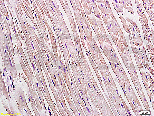Formalin-fixed and paraffin embedded rat heart tissue labeled Anti-Connexin 43 Polyclonal Antibody, Unconjugated (bs-0651R) at 1:200, followed by conjugation to the secondary antibody and DAB staining