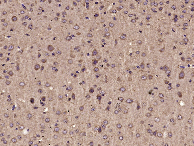 Paraformaldehyde-fixed, paraffin-embedded Mouse Brain tissue; Antigen retrieval by boiling in sodium citrate buffer (0.01M, pH6) for 15 minutes; Block endogenous peroxidase by 3% hydrogen peroxide for 30 minutes; Blocking buffer (3% BSA) at room temperature for 30 minutes; Antibody incubation with Parvalbumin Polyclonal Antibody, Unconjugated (bs-1299R) at 1:400 overnight at 4°C, followed by incubation with a conjugated secondary antibody, DAB and counterstaining.