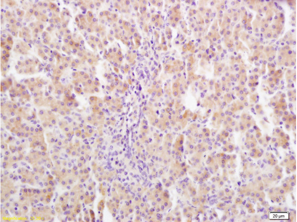 Formalin-fixed and paraffin embedded rat liver tissue labeled Anti-GHR Polyclonal Antibody, Unconjugated (bs-0654R) at 1:400, followed by conjugation to the secondary antibody and DAB staining