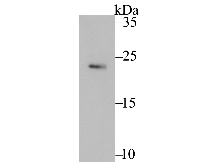 Lane 1: SiHa Cells; Probed with Securin (1F10) Monoclonal Antibody (bsm-54295R) at 1:500 overnight at 4°C followed by a conjugated secondary antibody for 60 minutes at 37°C. Lane 1: SiHa Cells; Probed with Securin (1F10) Monoclonal Antibody (bsm-54295R) at 1:500 overnight at 4°C followed by a conjugated secondary antibody for 60 minutes at 37°C.