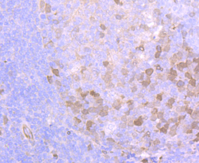 Paraformaldehyde-fixed and paraffin-embedded Human Tonsil tissue incubated with Securin (1F10) Monoclonal Antibody (bsm-54295R) at 1:100, overnight at 4°C, followed by a conjugated secondary antibody and DAB staining. Counterstained with hematoxylin.
