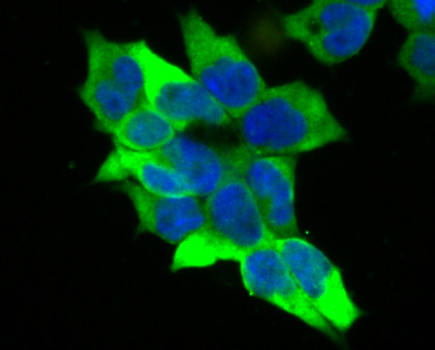 IF(ICC) staining with Creatine Kinase B (1D8) Monoclonal Antibody (bsm-54297R) at 1:100 in 293T cells (green). The nuclear counterstain is DAPI (blue). Cells were fixed in paraformaldehyde, permeabilized with 0.25% Triton X100/PBS.