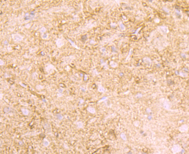 Paraformaldehyde-fixed and paraffin-embedded Rat Brain tissue incubated with Creatine Kinase B (1D8) Monoclonal Antibody (bsm-54297R) at 1:100, overnight at 4°C, followed by a conjugated secondary antibody and DAB staining. Counterstained with hematoxylin.
