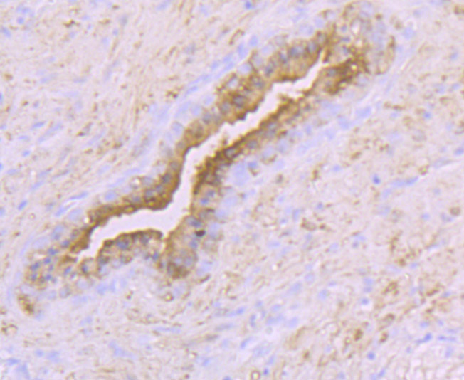 Paraformaldehyde-fixed and paraffin-embedded Human Prostate tissue incubated with Creatine Kinase B (1D8) Monoclonal Antibody (bsm-54297R) at 1:100, overnight at 4°C, followed by a conjugated secondary antibody and DAB staining. Counterstained with hematoxylin.