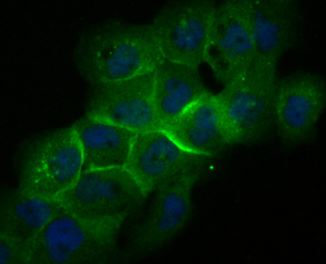 IF(ICC) staining with Galectin 8 (1A4) Monoclonal Antibody (bsm-54301R) at 1:100 in A431 cells (green). The nuclear counterstain is DAPI (blue). Cells were fixed in paraformaldehyde, permeabilized with 0.25% Triton X100/PBS.