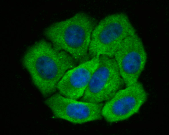 IF(ICC) staining with Galectin 8 (1A4) Monoclonal Antibody (bsm-54301R) at 1:100 in HepG2 cells (green). The nuclear counterstain is DAPI (blue). Cells were fixed in paraformaldehyde, permeabilized with 0.25% Triton X100/PBS.