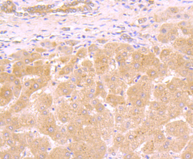 Paraformaldehyde-fixed and paraffin-embedded Human Liver tissue incubated with Galectin 8 (1A4) Monoclonal Antibody (bsm-54301R) at 1:100, overnight at 4°C, followed by a conjugated secondary antibody and DAB staining. Counterstained with hematoxylin.
