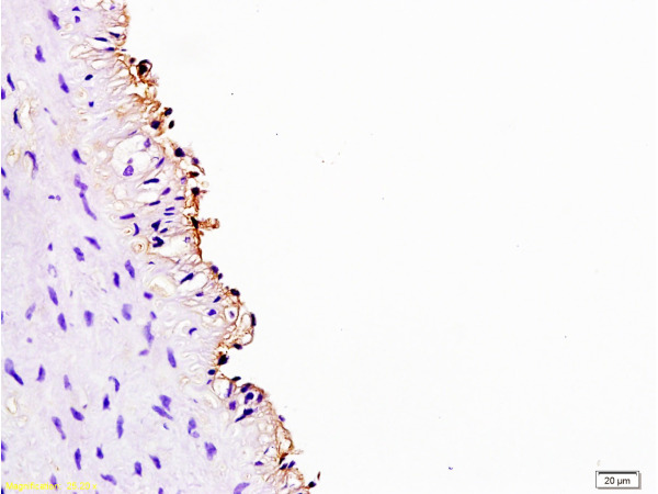 Formalin-fixed and paraffin embedded rabbit carotid artery labeled Anti-Cyclin D3 Polyclonal Antibody, Unconjugated (bs-0660R) at 1:200, followed by conjugation to the secondary antibody and DAB staining