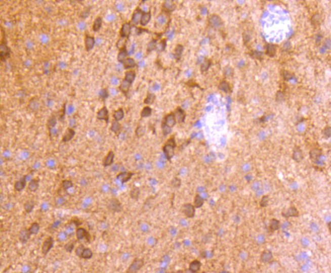 Paraformaldehyde-fixed and paraffin-embedded Rat brain tissue incubated with CaMK\u2161 (1H12) Monoclonal Antibody (bsm-52427R) at 1:100, overnight at 4\u00b0C, followed by a conjugated secondary antibody and DAB staining. Counterstained with hematoxylin.