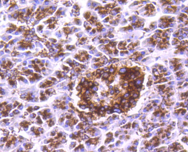 Paraformaldehyde-fixed and paraffin-embedded Human pancreas tissue incubated with Cathepsin D (2G4) Monoclonal Antibody (bsm-52429R) at 1:300, overnight at 4°C, followed by a conjugated secondary antibody and DAB staining. Counterstained with hematoxylin.