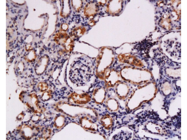 Formalin-fixed and paraffin embedded rat kidney tissue labeled Anti-CD117\/c-kit\/SCFR Polyclonal Antibody, Unconjugated (bs-0672R) at 1:200, followed by conjugation to the secondary antibody and DAB staining