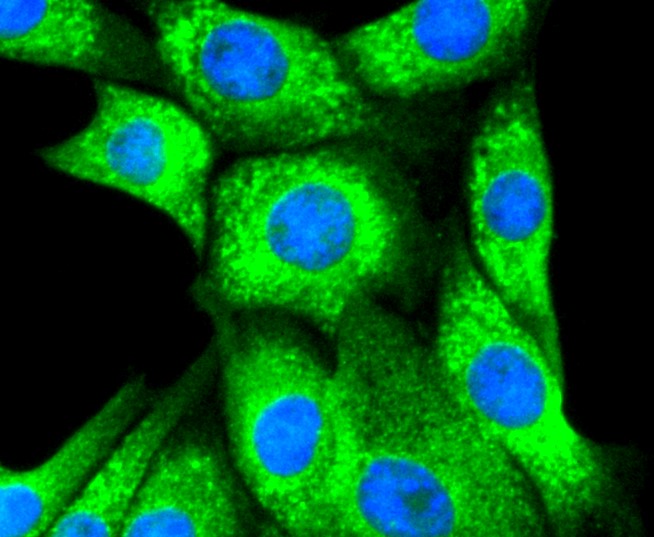 IF(ICC) staining with Calreticulin (3D1) Monoclonal Antibody (bsm-52436R) at 1:300 in NIH/3T3 cells (green). The nuclear counterstain is DAPI (blue). Cells were fixed in paraformaldehyde, permeabilized with 0.25% Triton X100/PBS.