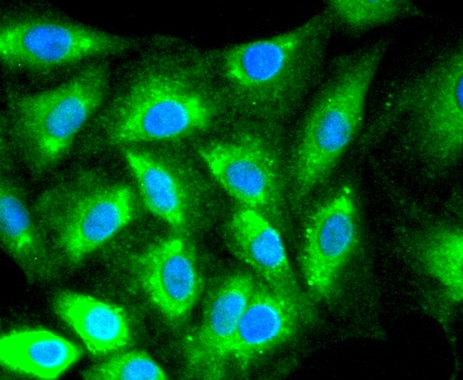 IF(ICC) staining with Calreticulin (3D1) Monoclonal Antibody (bsm-52436R) at 1:300 in L6 cells (green). The nuclear counterstain is DAPI (blue). Cells were fixed in paraformaldehyde, permeabilized with 0.25% Triton X100/PBS.