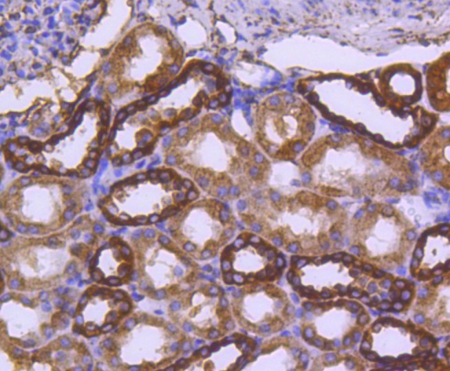 Paraformaldehyde-fixed and paraffin-embedded Human kidney tissue incubated with Calreticulin (3D1) Monoclonal Antibody (bsm-52436R) at 1:100, overnight at 4°C, followed by a conjugated secondary antibody and DAB staining. Counterstained with hematoxylin.
