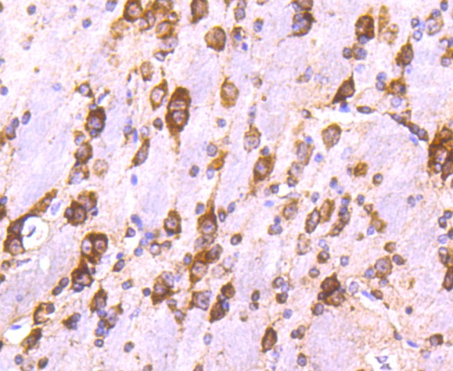 Paraformaldehyde-fixed and paraffin-embedded Mouse brain tissue incubated with Calreticulin (3D1) Monoclonal Antibody (bsm-52436R) at 1:100, overnight at 4°C, followed by a conjugated secondary antibody and DAB staining. Counterstained with hematoxylin.