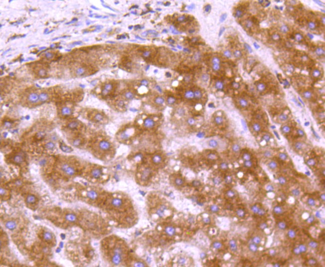Paraformaldehyde-fixed and paraffin-embedded Human liver tissue incubated with Calreticulin (3D1) Monoclonal Antibody (bsm-52436R) at 1:100, overnight at 4°C, followed by a conjugated secondary antibody and DAB staining. Counterstained with hematoxylin.