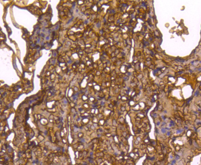 Paraformaldehyde-fixed and paraffin-embedded Human lung tissue incubated with Caspase-1 (1E8) Monoclonal Antibody (bsm-52441R) at 1:100, overnight at 4°C, followed by a conjugated secondary antibody and DAB staining. Counterstained with hematoxylin.