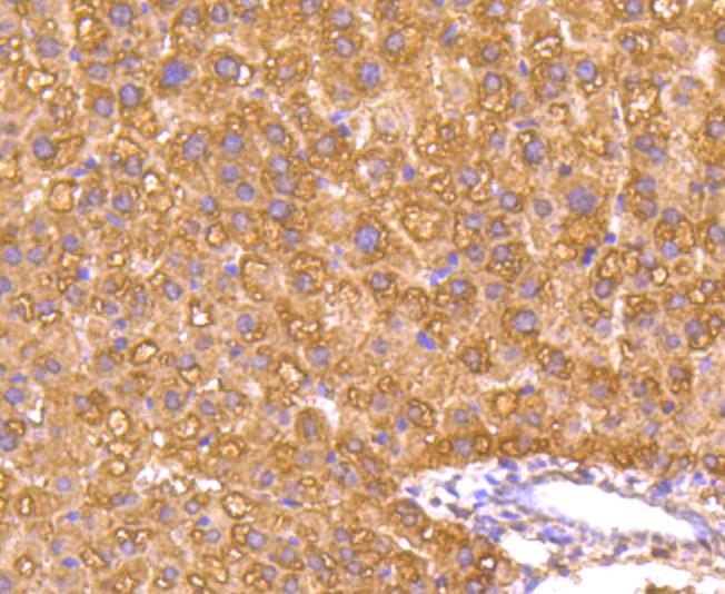 Paraformaldehyde-fixed and paraffin-embedded Mouse liver tissue incubated with Caspase-1 (1E8) Monoclonal Antibody (bsm-52441R) at 1:100, overnight at 4°C, followed by a conjugated secondary antibody and DAB staining. Counterstained with hematoxylin.