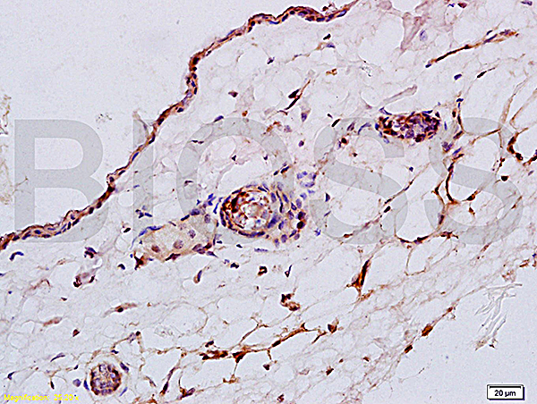 Formalin-fixed and paraffin embedded: rat skin tissue labeled with Anti-CK4 Polyclonal Antibody (bs-1006R), Unconjugated at 1:200, followed by conjugation to the secondary antibody and DAB staining