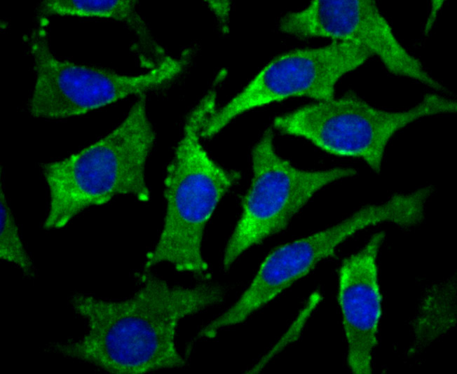 IF(ICC) staining with DCP1A (3F4) Monoclonal Antibody (bsm-54272R) at 1:100 in SH-SY5Y cells (green). The nuclear counterstain is DAPI (blue). Cells were fixed in paraformaldehyde, permeabilized with 0.25% Triton X100/PBS.