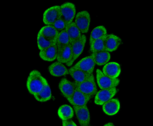 IF(ICC) staining with DCP1A (3F4) Monoclonal Antibody (bsm-54272R) at 1:100 in LOVO cells (green). The nuclear counterstain is DAPI (blue). Cells were fixed in paraformaldehyde, permeabilized with 0.25% Triton X100/PBS.