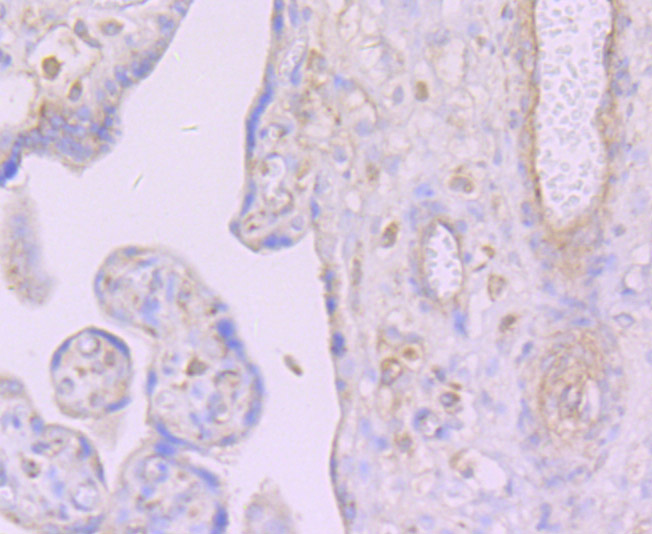 Paraformaldehyde-fixed and paraffin-embedded Human Placenta tissue incubated with DCP1A (3F4) Monoclonal Antibody (bsm-54272R) at 1:100, overnight at 4°C, followed by a conjugated secondary antibody and DAB staining. Counterstained with hematoxylin.