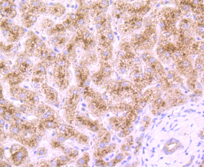 Paraformaldehyde-fixed and paraffin-embedded Human Liver tissue incubated with DCP1A (3F4) Monoclonal Antibody (bsm-54272R) at 1:100, overnight at 4°C, followed by a conjugated secondary antibody and DAB staining. Counterstained with hematoxylin.