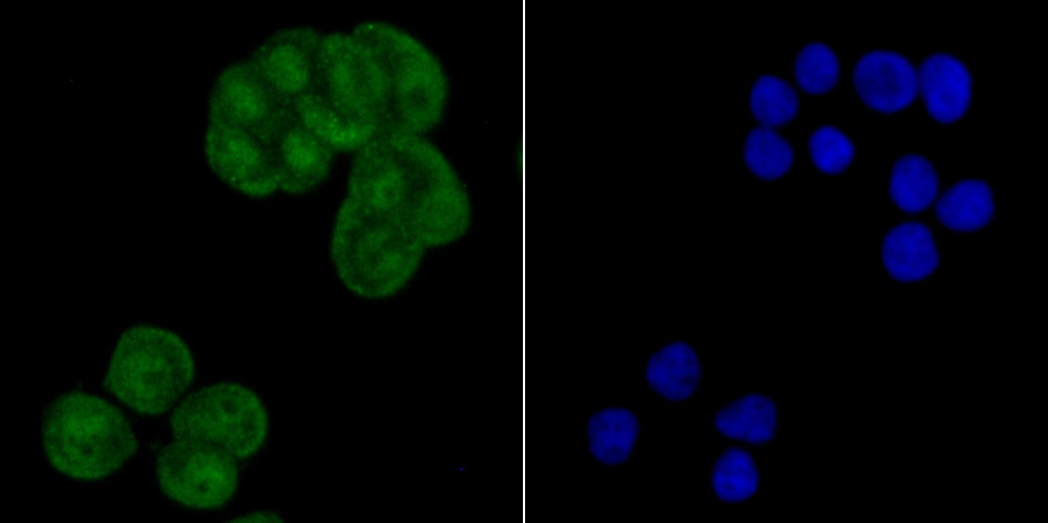 IF(ICC) staining with Exportin-1 (2C4) Monoclonal Antibody (bsm-54273R) at 1:100 in LOVO cells (green). The nuclear counterstain is DAPI (blue). Cells were fixed in paraformaldehyde, permeabilized with 0.25% Triton X100/PBS.