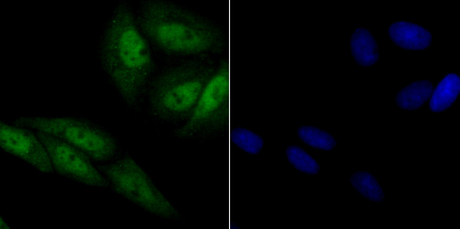 IF(ICC) staining with Exportin-1 (2C4) Monoclonal Antibody (bsm-54273R) at 1:100 in SiHa cells (green). The nuclear counterstain is DAPI (blue). Cells were fixed in paraformaldehyde, permeabilized with 0.25% Triton X100/PBS.